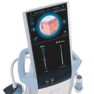 Exion Face Tightening | RSVP Beauty Clinic | Aesthetic Treatment Vancouver BC